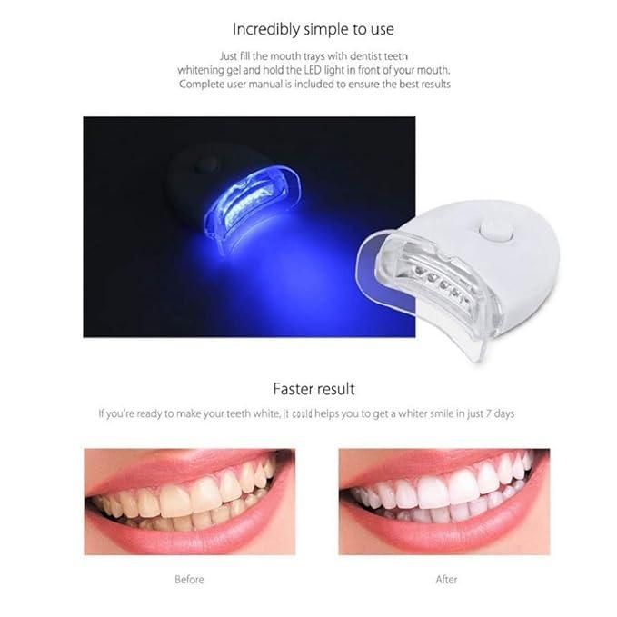 BrightSmile Teeth Whitening Kit